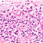 How Fluoride Affects Your Pineal Gland (And What to Do About It)