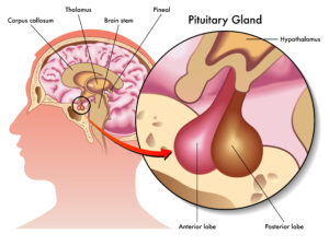 Decalcifying the Pineal Gland: Natural Remedies That Actually Work